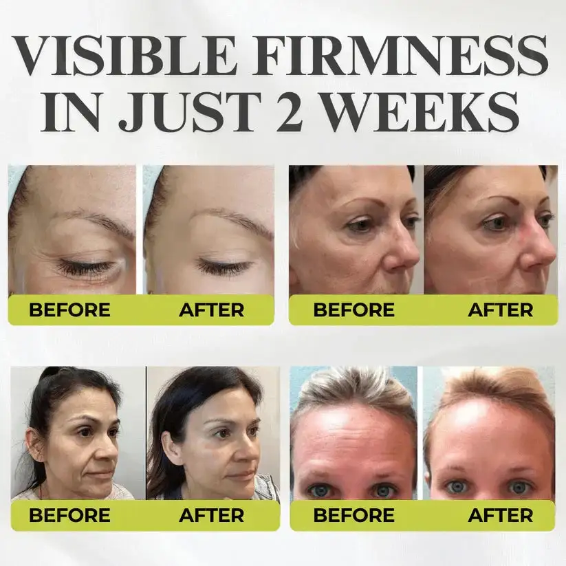 Advanced Peptide Botox-Style + Vita-A Retinol Lifting Renewal Cream - Image 6