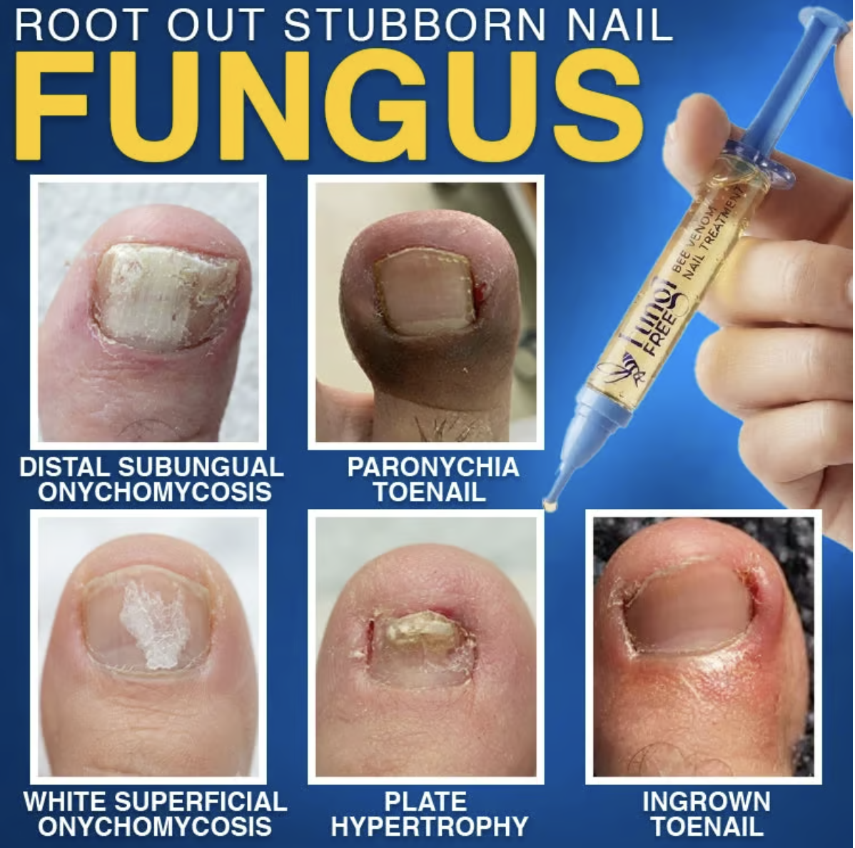 FungiFree Bee Venom Nail Treatment - Image 2