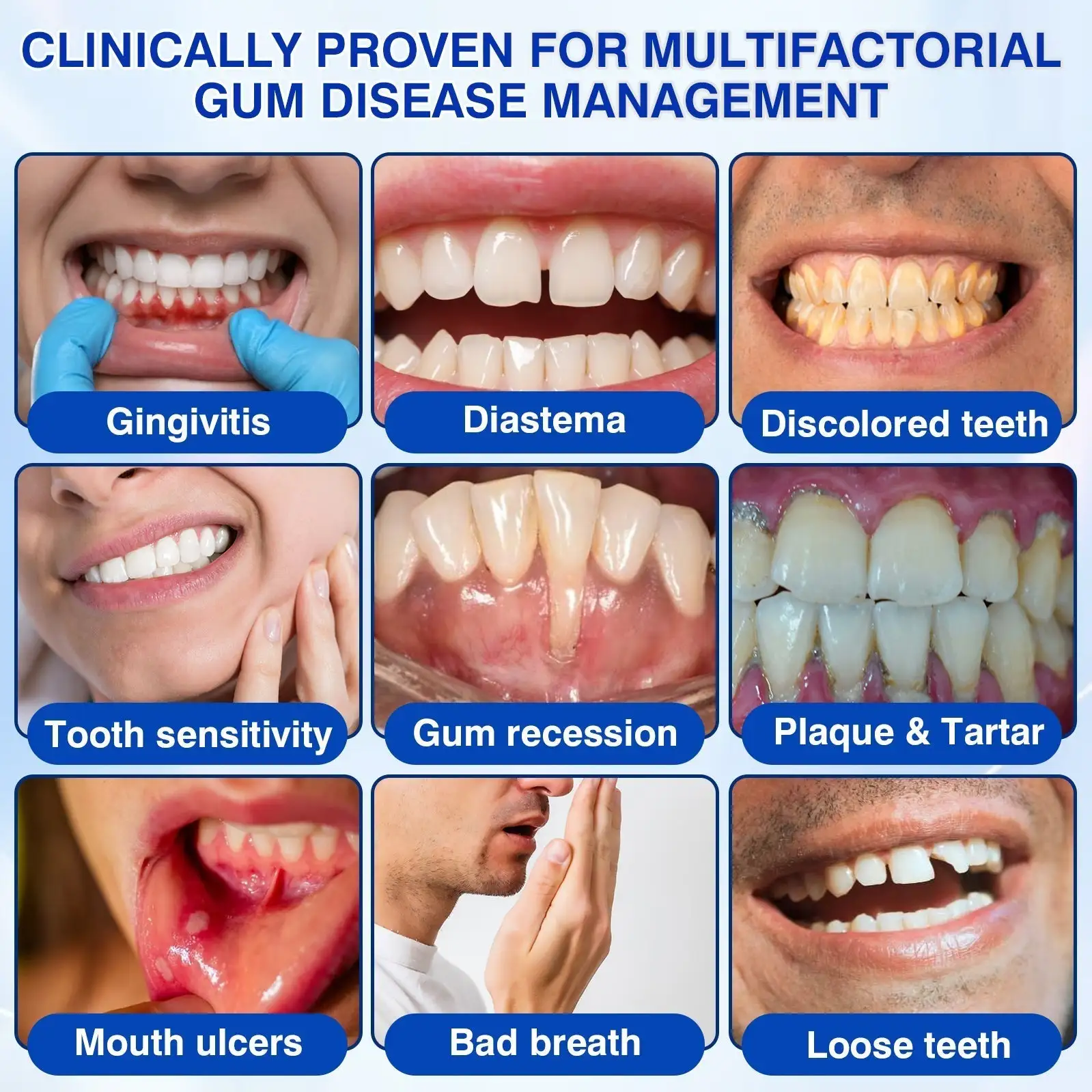 Tiworld ® Gum health Periodontal Repair Gel - Image 6