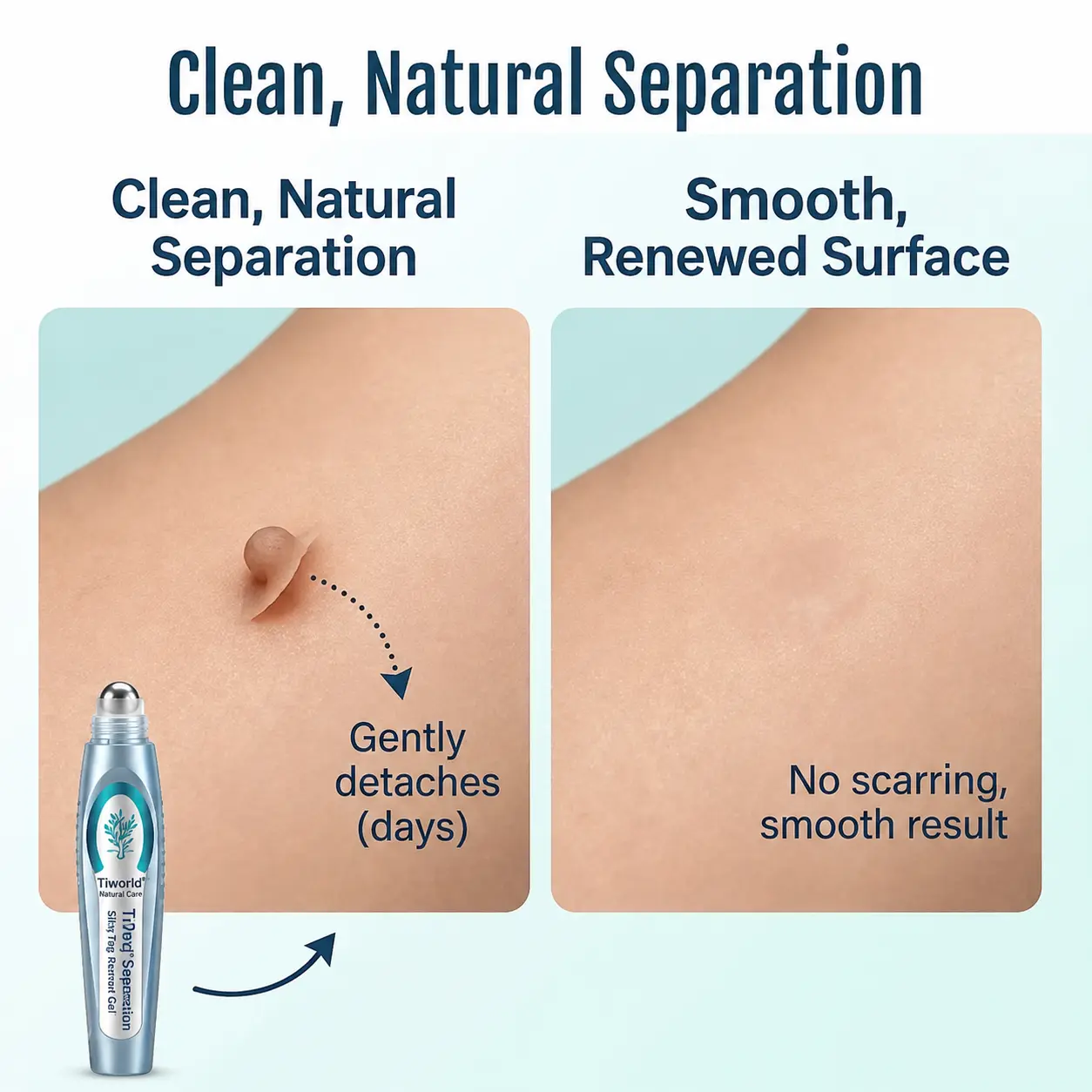 SpotlessPro Advanced Skin Care Pen - Image 8