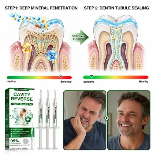 CavityReverse Pept11 MicroFill Gel - Image 8